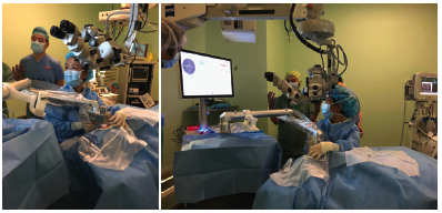 Management of Complex Cataracts With Low Energy Femtosecond Laser Surgery