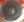 Figure 2. A hard cataract with a nondilating pupil and lens subluxation.