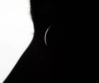 I Had Cataract Surgery and Heres What Happened