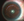 Figure 2. Normal image of flap gutter after repositioning over the well-centered Raindrop inlay.