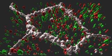 NIH Study Traces Molecular Link From Gene to Late-Onset Retinal Degeneration image