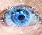 Cataract Surgery After a Phakic IOL