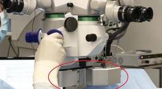 Assessing the CapsuLaser for Primary Posterior Capsulotomy