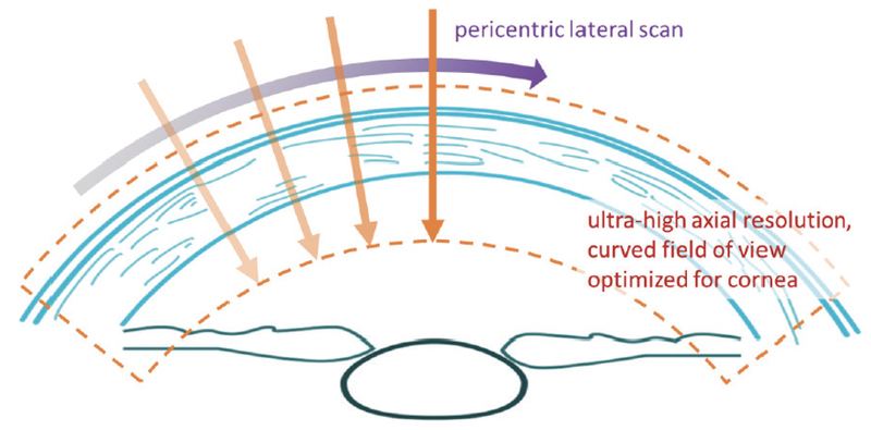 Redefining Corneal Tomography Introducing the Pentacam Cornea OCT