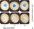 New Horizons in Corneal Endothelial Therapy