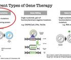 Gene Therapy for the Retina