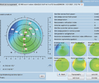 Clinical Value and Use of the Eyestar 900s Cataract Suite
