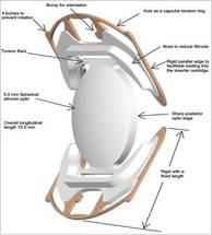 CORD LLC Completes One-Year Follow-Up on Subjects From the Model SC9 Intraocular Lens FDA Clinical Trial image