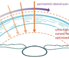 Redefining Corneal Tomography Introducing the Pentacam Cornea OCT