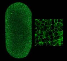 First US Patient Receives Autologous Stem Cell Therapy to Treat Dry AMD image