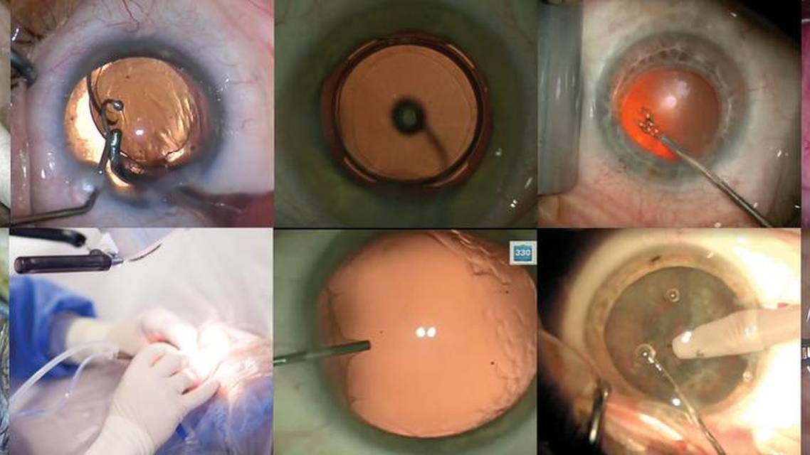 A Routine Case