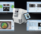 How the Eyestar 900 Can Improve Workflow