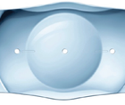 Proven Clinical Outcomes With the EVO Visian Toric ICL