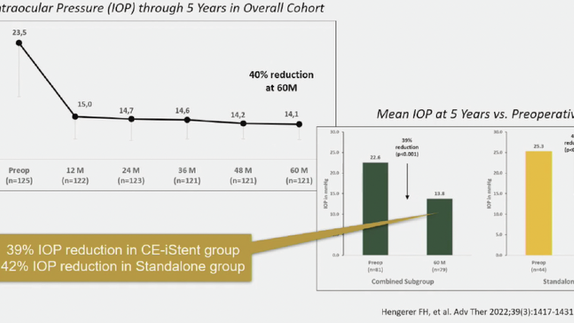 Why Real World Data Is Important for Glaucoma