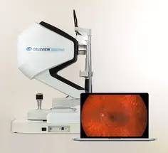 EssilorLuxottica Acquires Canadian Med-Tech Start-Up Cellview image