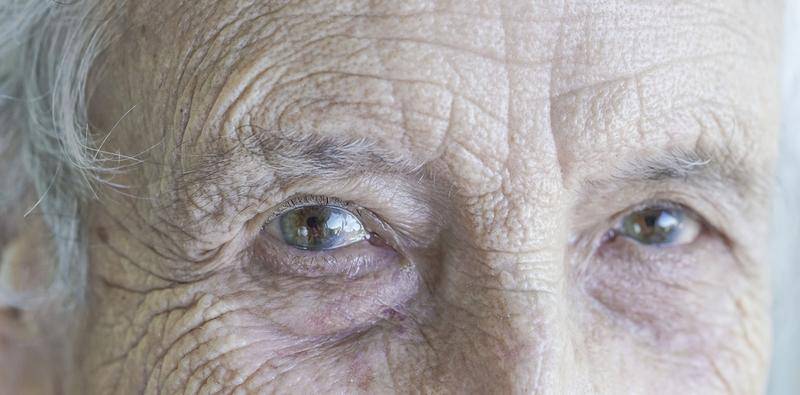 A Noninvasive Alternative to Cataract Surgery