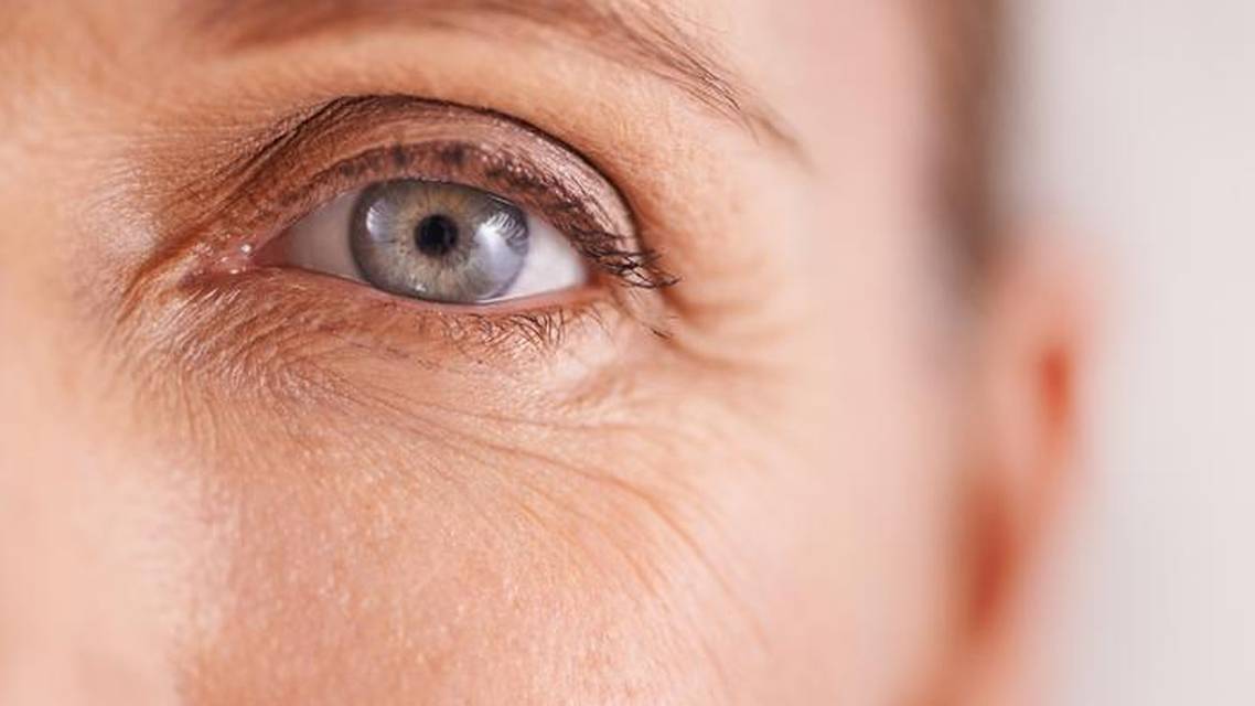 Pressure Induced Stromal Keratitis