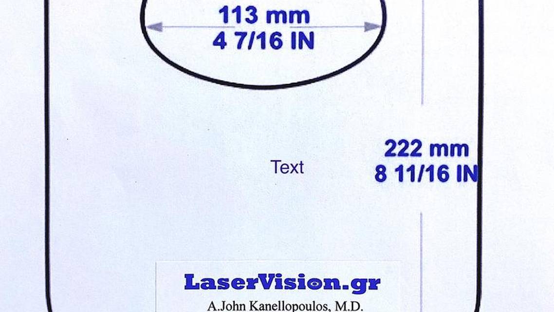 Slit Lamp Droplet Shield