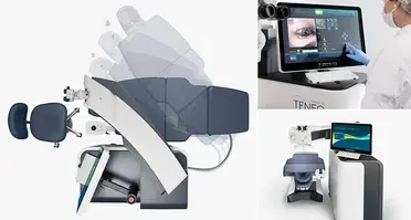Bausch + Lomb Publishes Teneo Excimer Laser Clinical Trial Results image