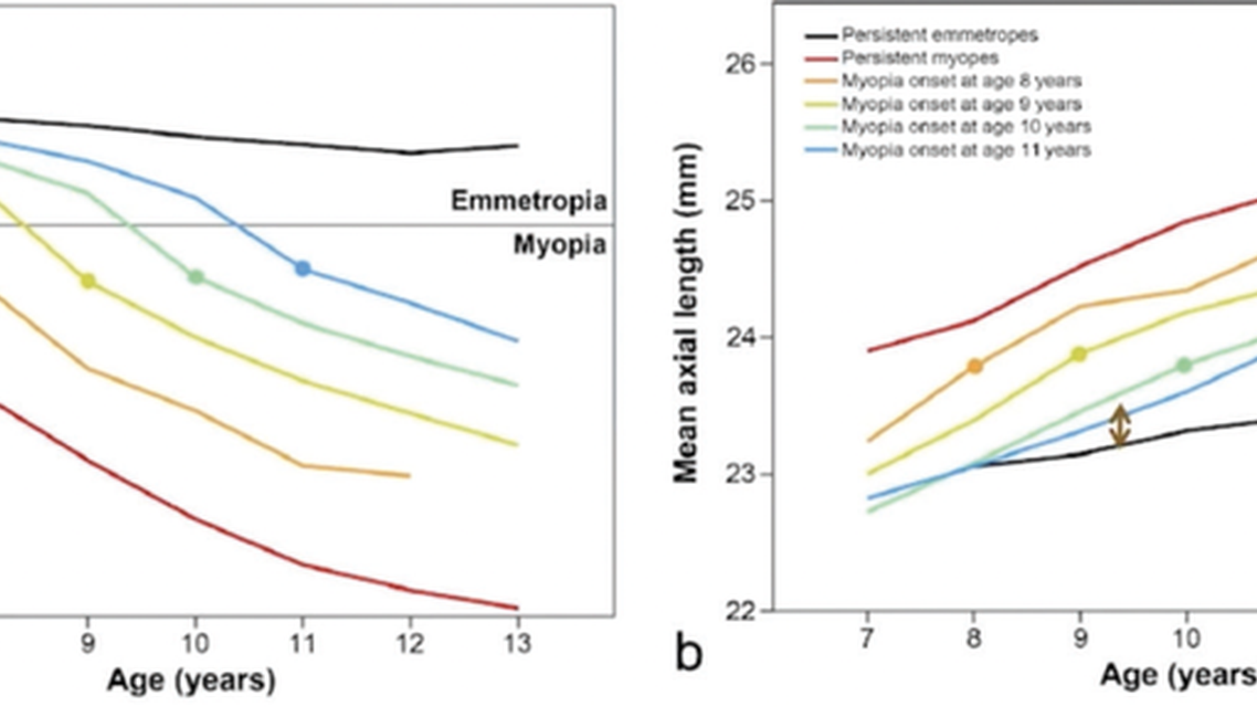 Utilizing Growth Curves With MYAH Early Detection and Reliable Quantification of Myopic Ocular Growth