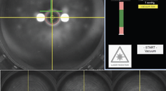ATOS and SmartSight Current Trends and Procedural Volume