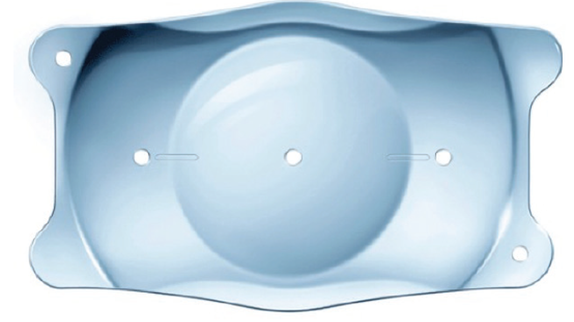 Proven Clinical Outcomes With the EVO Visian Toric ICL