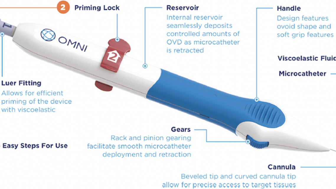 Practical Pointers for Ab Interno MIGS
