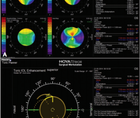 Advancing Cataract Surgery With Diagnostic Technologies