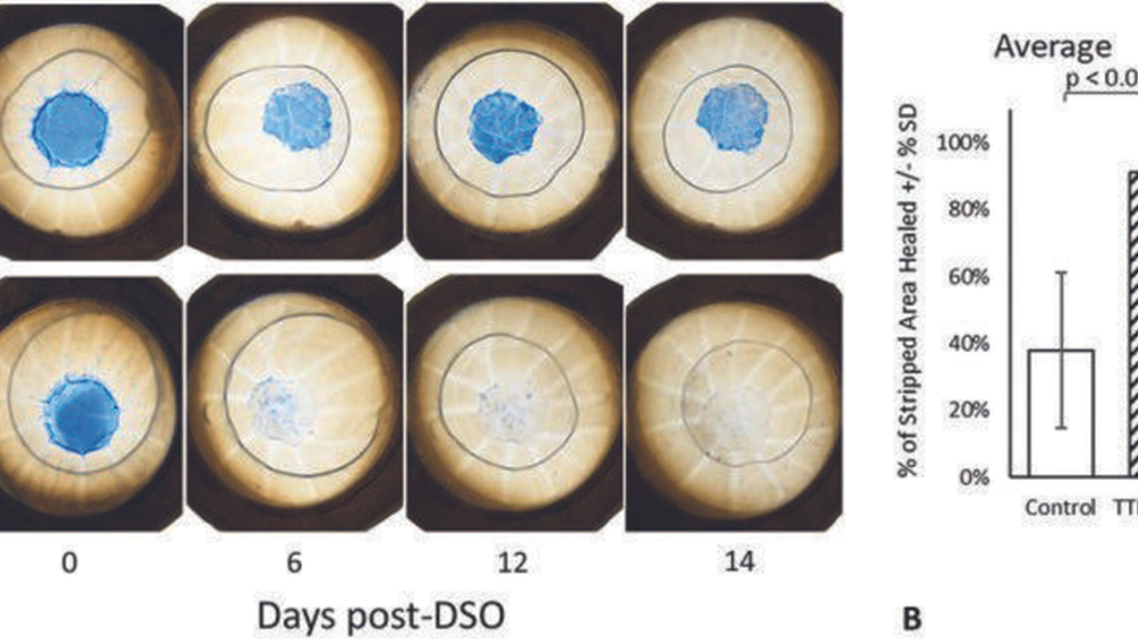 New Horizons in Corneal Endothelial Therapy