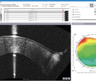 Augmented Awareness Supporting the Review Process with AI based Anomaly Detection in Corneal OCT