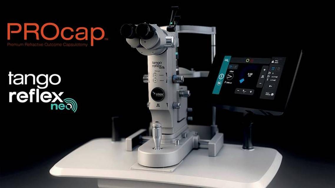 PROcap A New Way to Perform a Posterior Capsulotomy