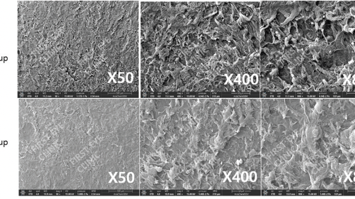 Scanning Electron Microscopy on ATOS SmartSight Lenticules