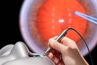 ESCRS Delegates Invited to Attend a ‘Cataract Surgery Virtual Reality (VR) Training Experience’ image