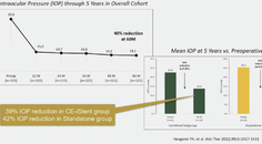 Why Real World Data Is Important for Glaucoma