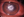 Figure. A central ring-shaped anterior to midstromal infiltrate with feathery margins and surrounding satellite lesions (arrow).