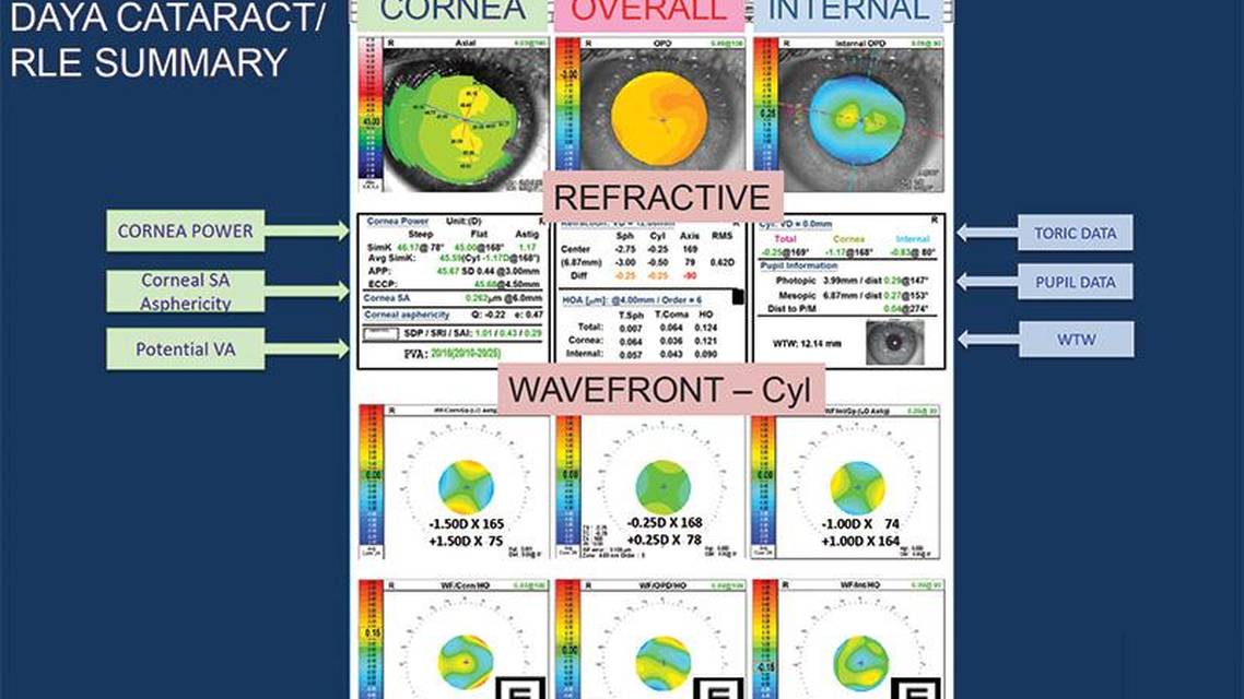 Preoperative Planning With the OPD Scan III