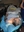 Figure 1. Rotated and flexed positioning associated with
kyphoscoliosis.