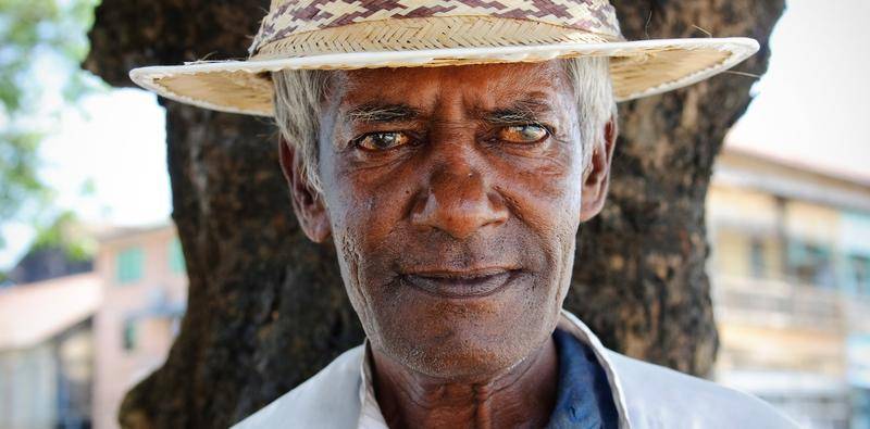 Global Cataract Blindness Our Responsibility and Our Opportunity