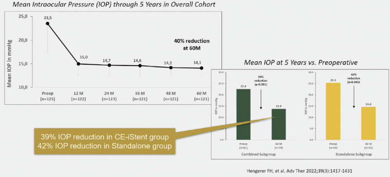 Why Real World Data Is Important for Glaucoma
