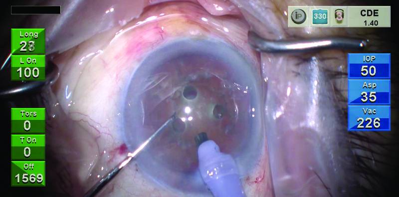 Rotary Chop