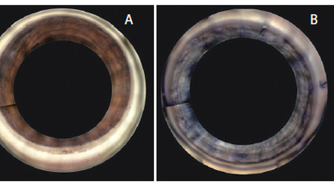 Automated Gonioscopy Improves the Ability to Review the Angle Anatomy