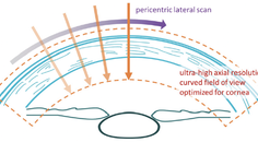Redefining Corneal Tomography Introducing the Pentacam Cornea OCT