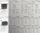 CS Case Hero CRSTG Issue 4 2026