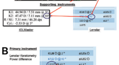 Hitting Your Target With Toric IOLs