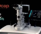 PROcap A New Way to Perform a Posterior Capsulotomy