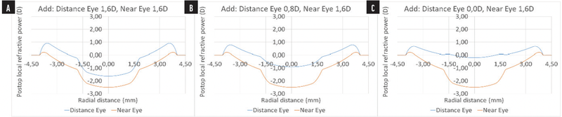 PresbyMAX Monocular