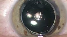 Small Aperture Optics An Old Principle Made New