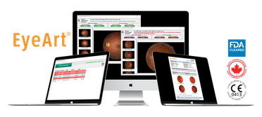 FDA Clearance Expands the Label of Eyenuk's EyeArt AI System for the Detection of DR image