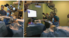 Management of Complex Cataracts With Low Energy Femtosecond Laser Surgery
