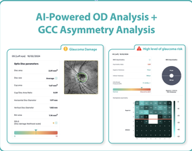 Altris AI Launches Advanced Optic Disc Analysis for Glaucoma, Complementing GCC Asymmetry Analysis image